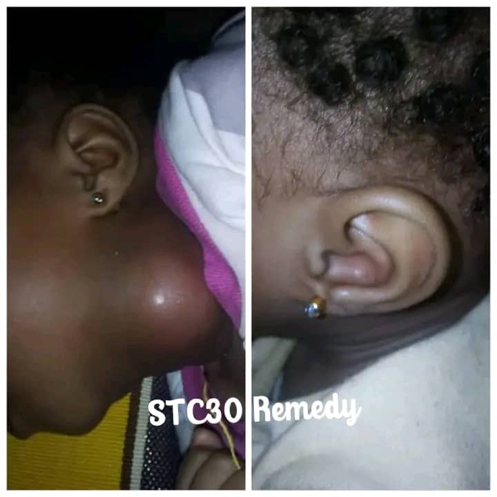 Customer before/after photo
